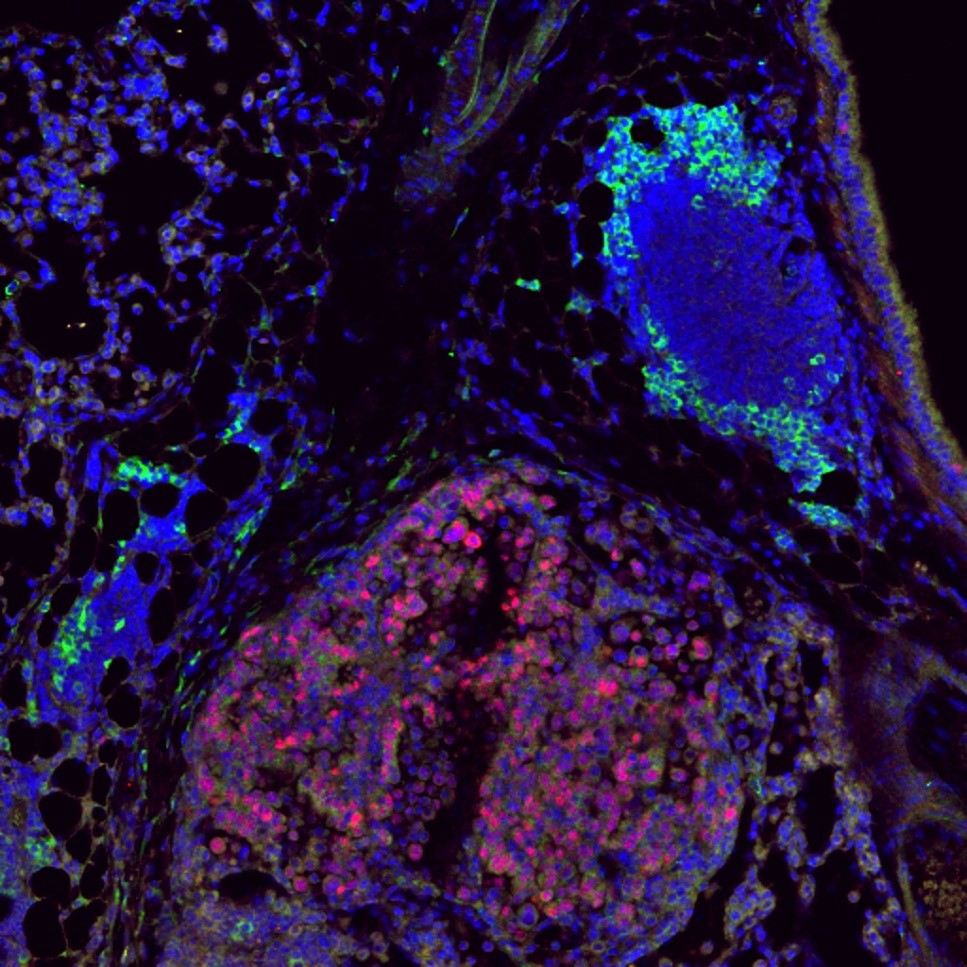 Photo of cells stained with fluorescent dyes